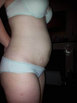 model Pure Warrior Maiden body modelling photo taken by @Stephanos_Baecere . this is an image of my belly after having my first child back in january 2014  i had the image taken about a month after his birth  i have not taken any since.
